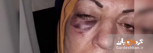 ضرب و شتم یک گردشگر زن عراقی در فرودگاه مشهد/عکس